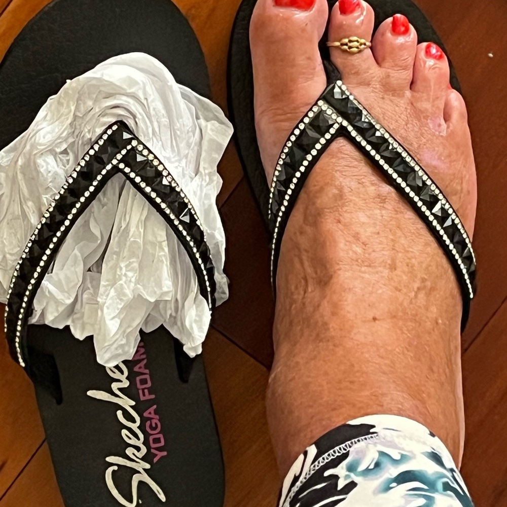 Skechers Black Sandals Casual Beachwear